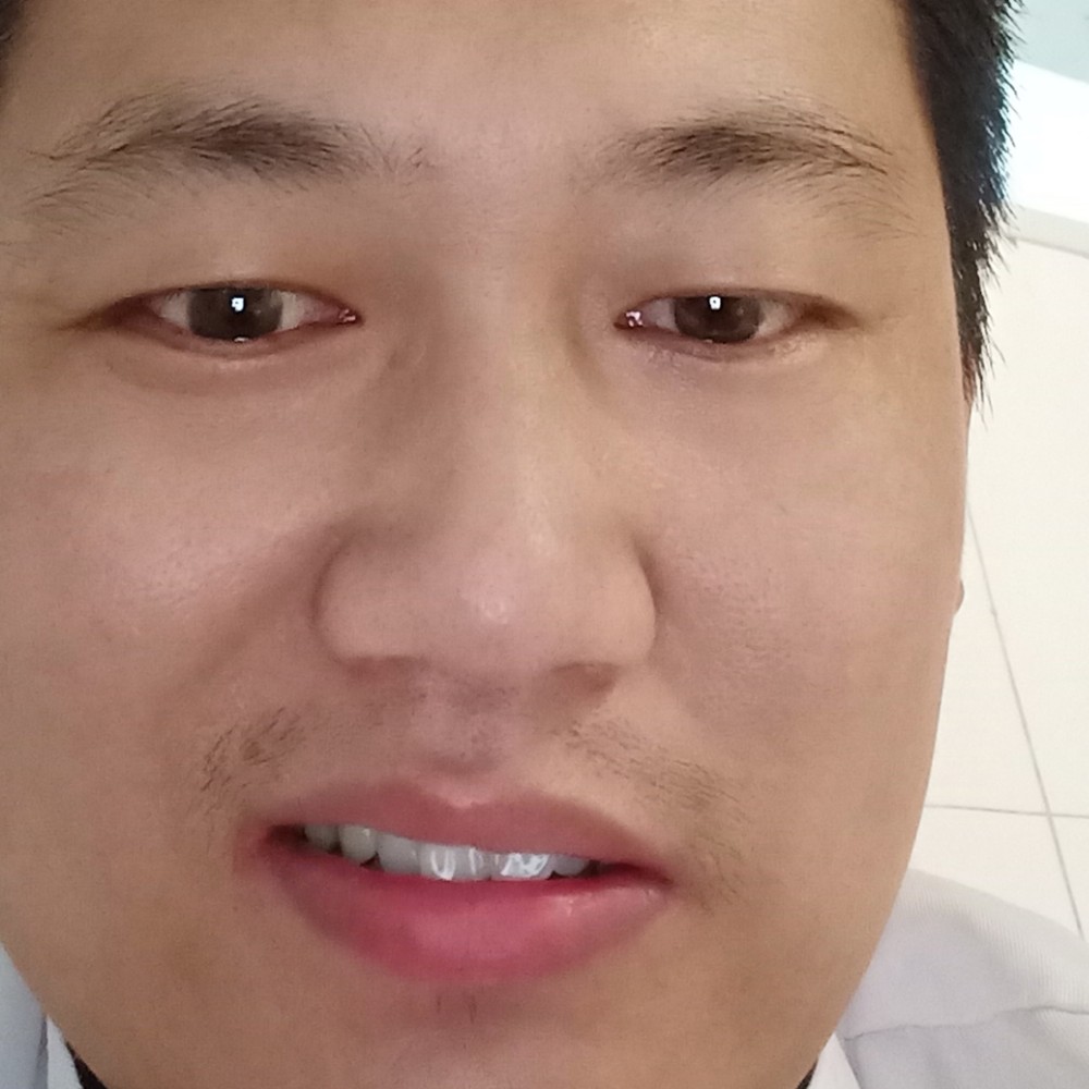 指甲油吃醋独特的照片