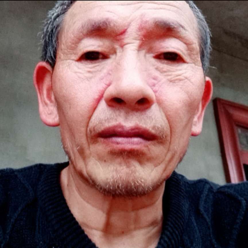 蜻蜓保卫鳗鱼的照片