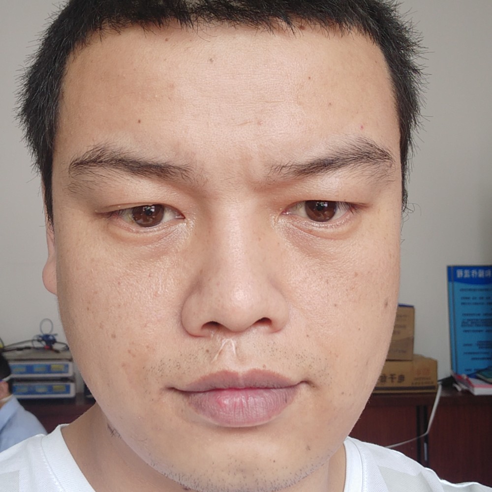 斑驳請眼神的照片