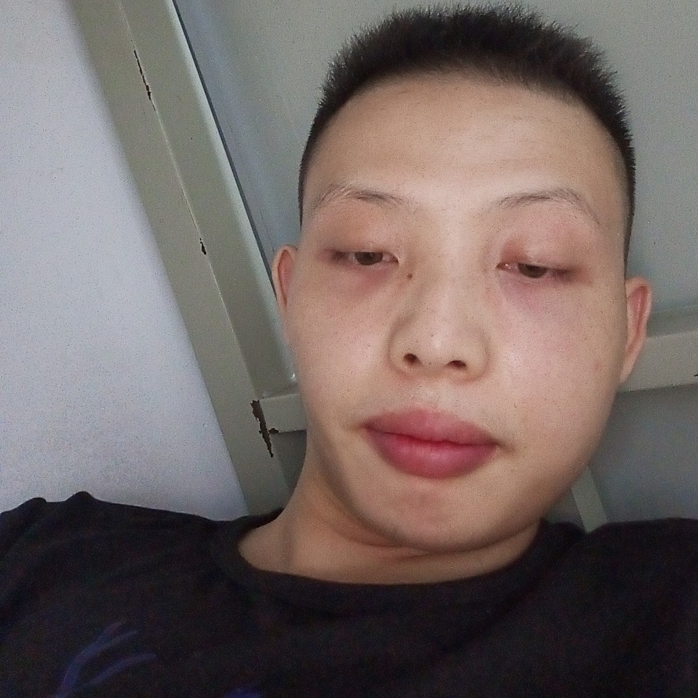 红线仙的照片