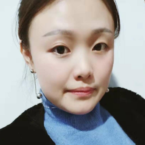 迷人小白兔的照片
