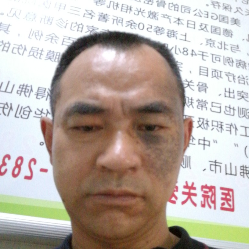深情凝眸老鼠的照片