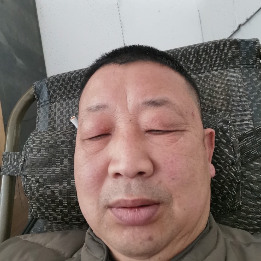 平湖花痴的照片