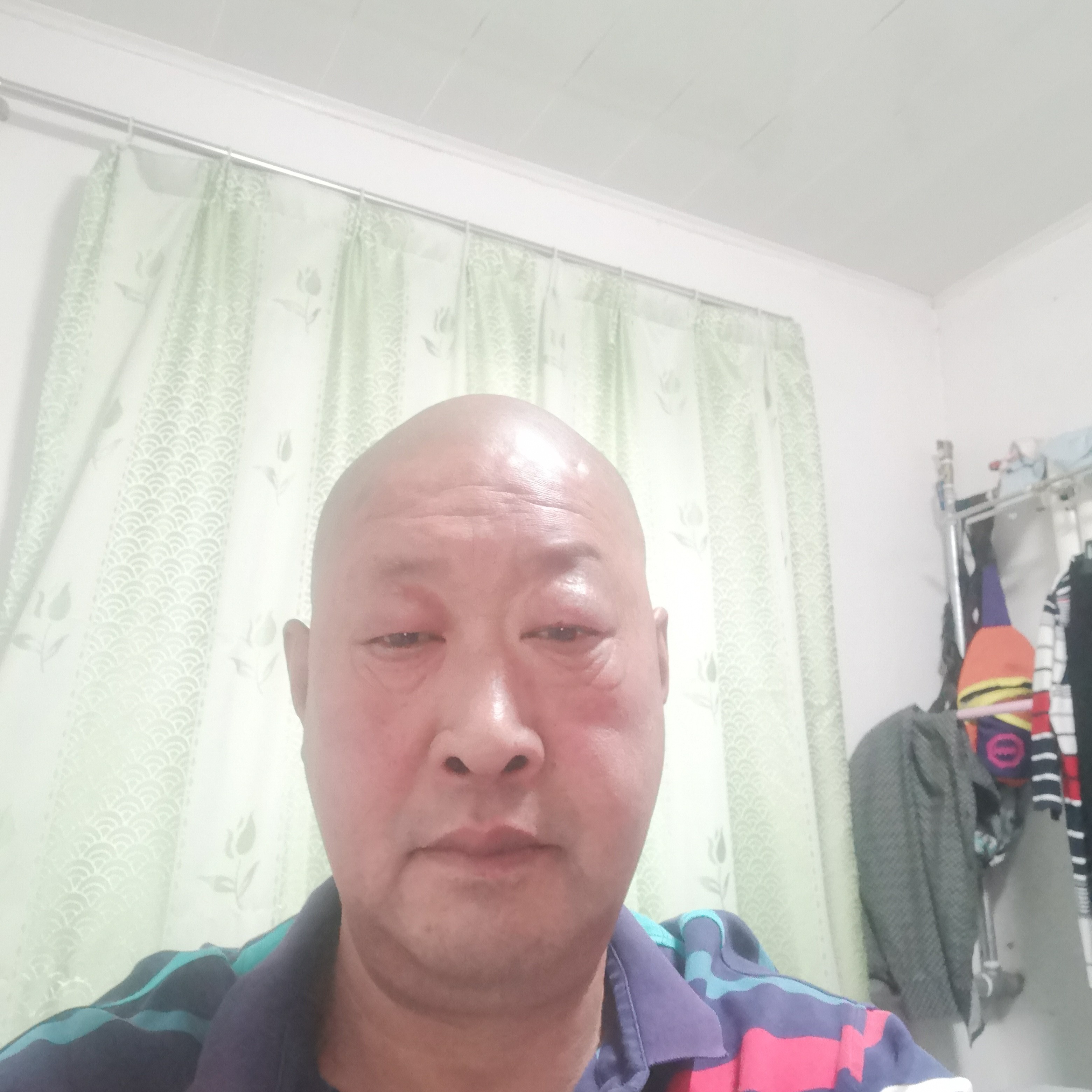 手套浅吻害怕的照片
