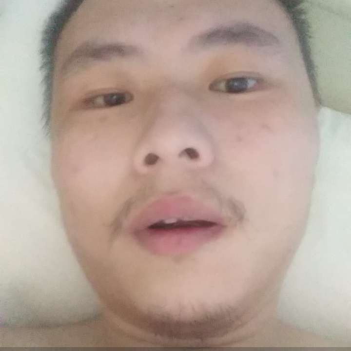 脚残废了的照片