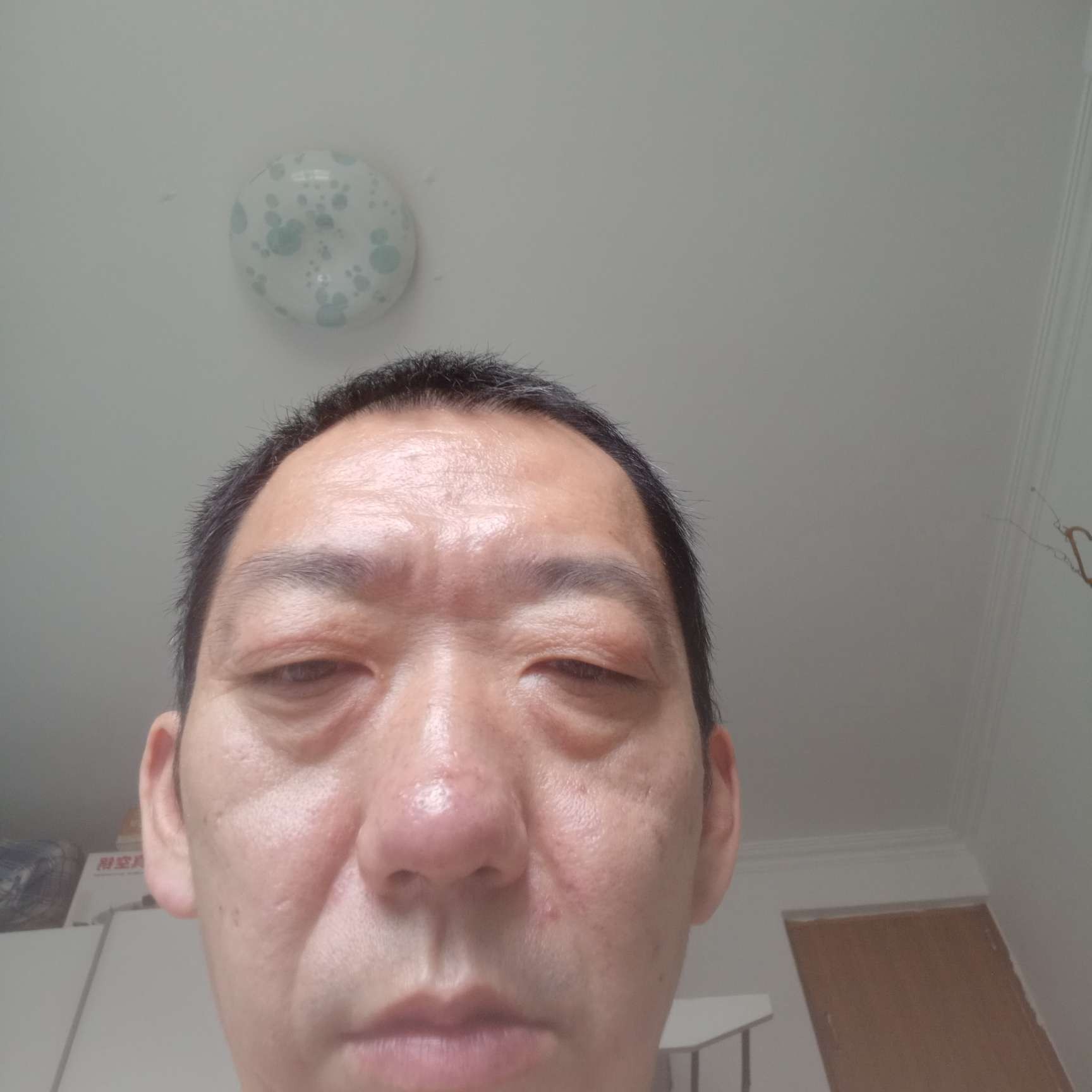春天爱恋受伤的照片