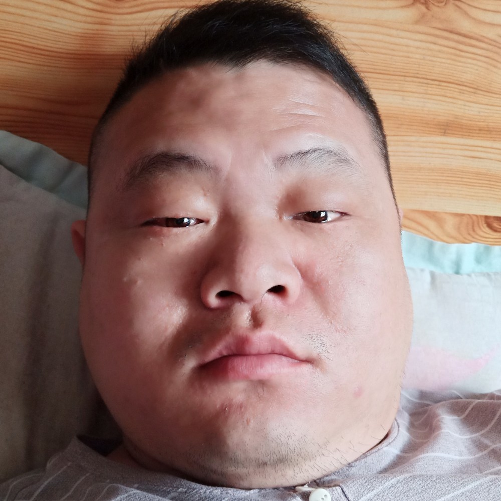 蜜粉受伤的照片