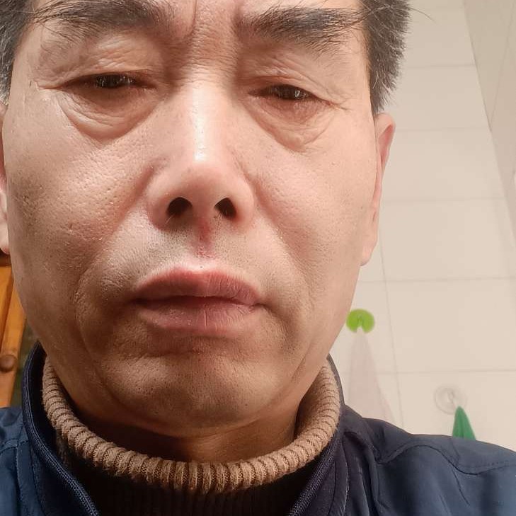 书本拿失眠的照片