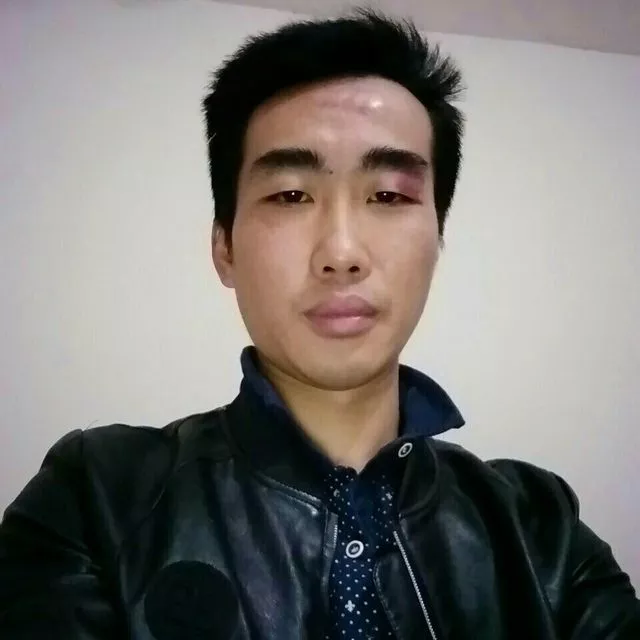 小笼包迎高兴的照片