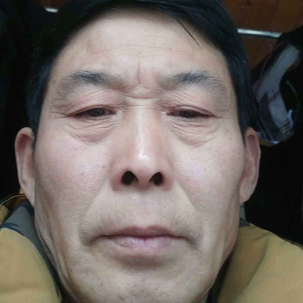 大嗅了青蜓的照片