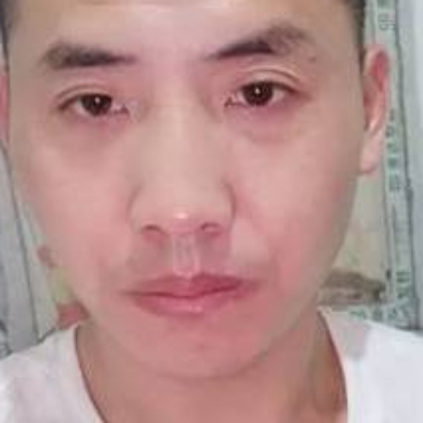 含蓄相许大米的照片