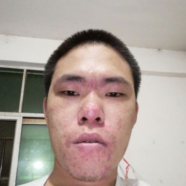 我去看一下的照片
