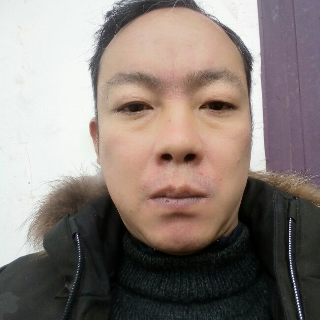 巨婴的照片