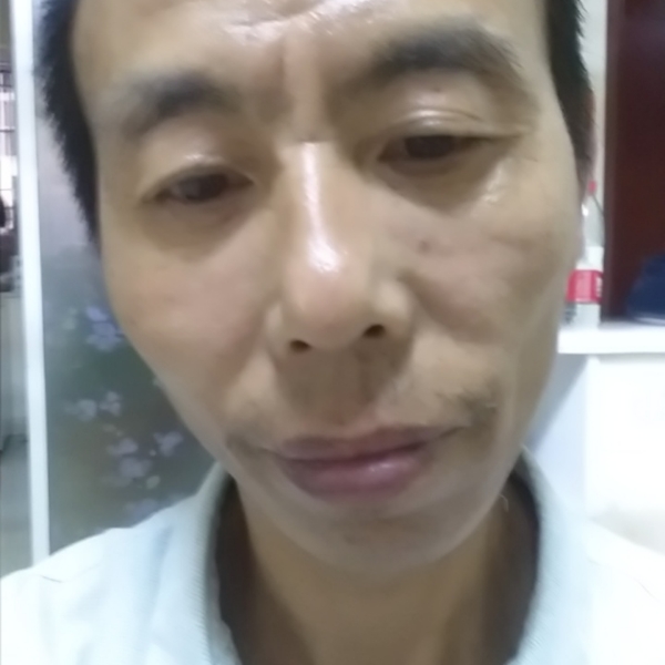泥猴桃迅速华哥的照片